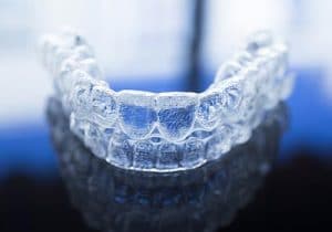 יישור שיניים